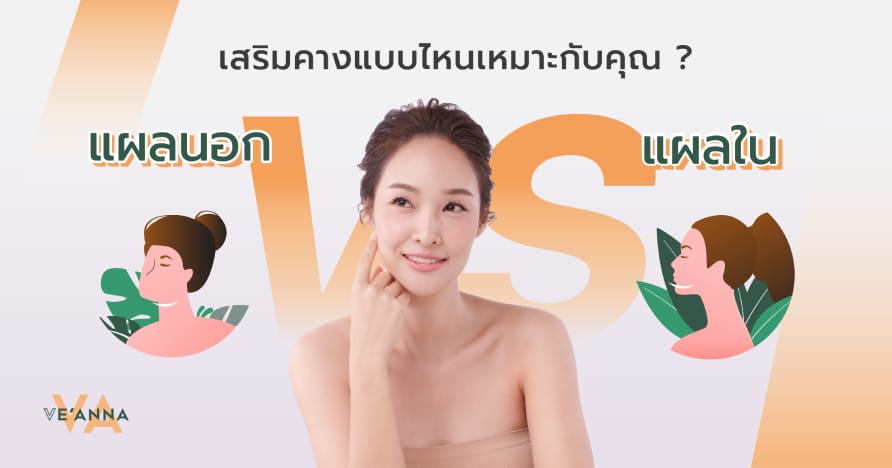 เสริมคางแผลนอก VS แผลใน แบบไหนเหมาะกับคุณ?