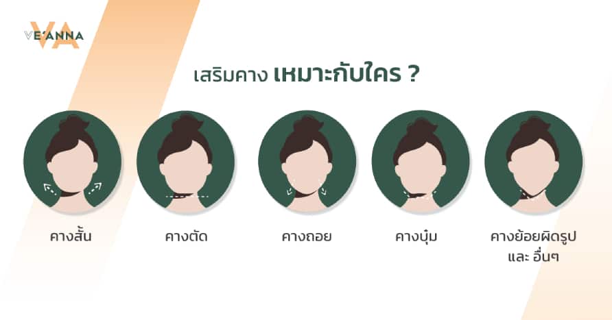 เสริมคาง ทำคาง ให้เข้ากับหน้า ที่ Ve’anna Clinic