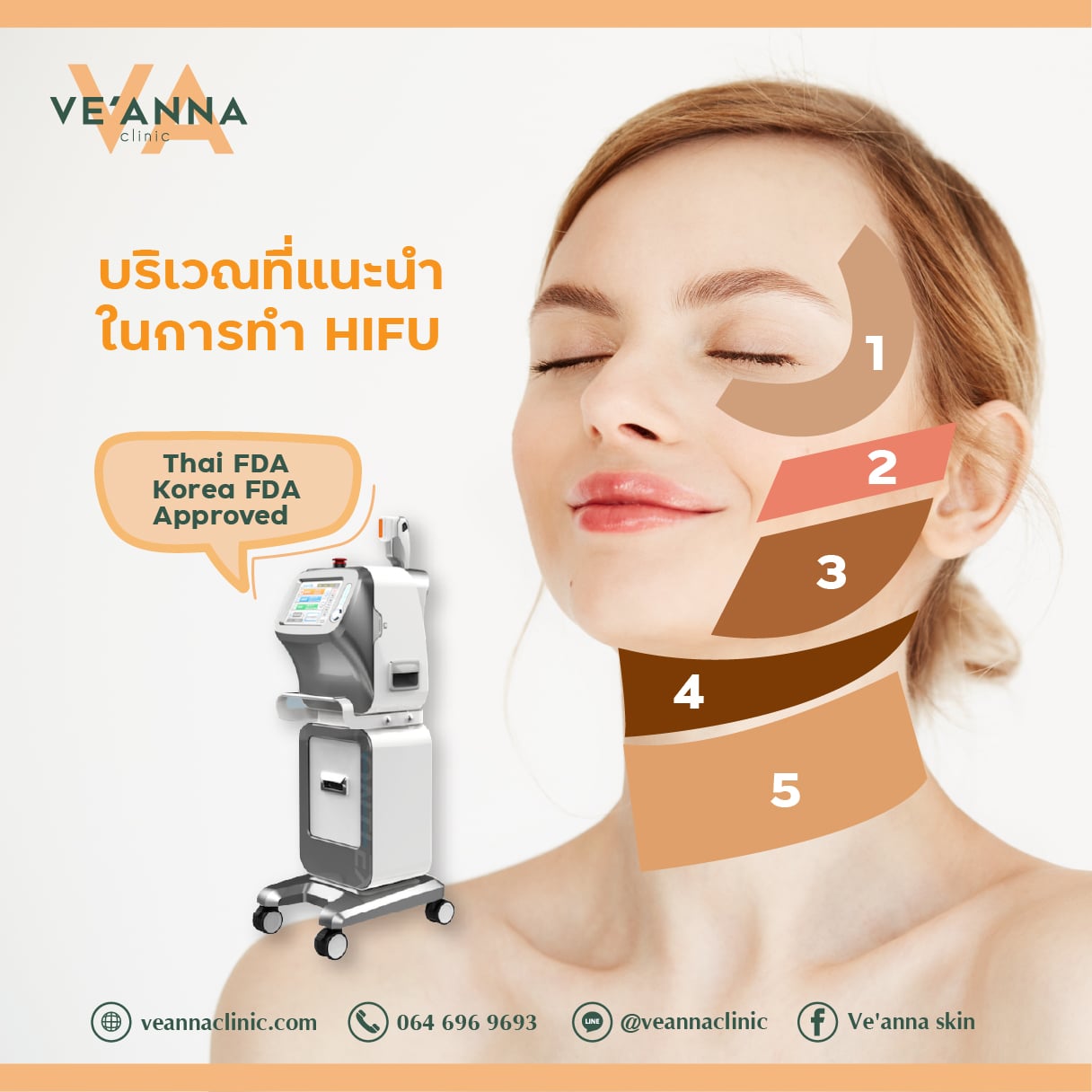ยกกระชับใบหน้า โดยไม่ต้องผ่าตัดด้วย HIFU