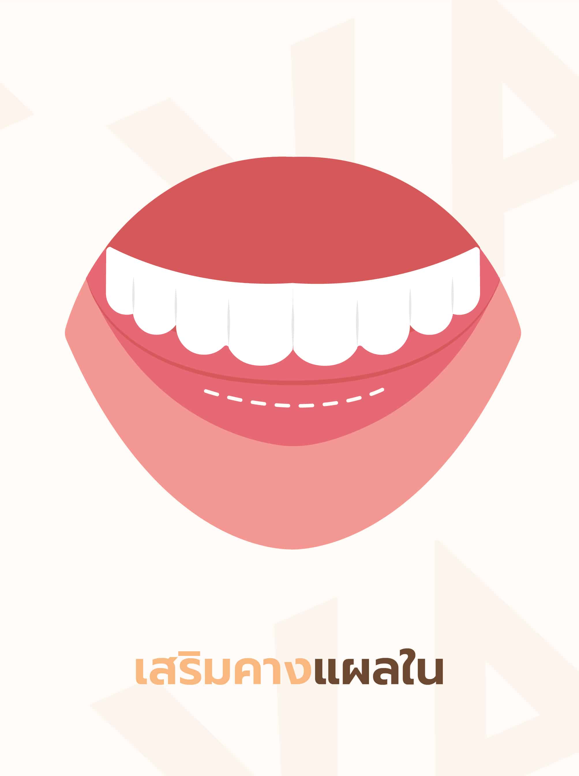 รวมเรื่องต้องรู้ก่อนเสริมคางผู้ชาย
