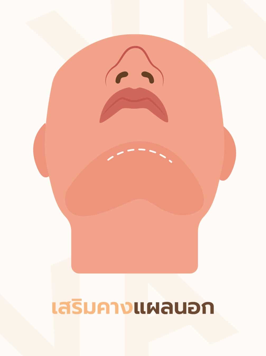 รวมเรื่องต้องรู้ก่อนเสริมคางผู้ชาย