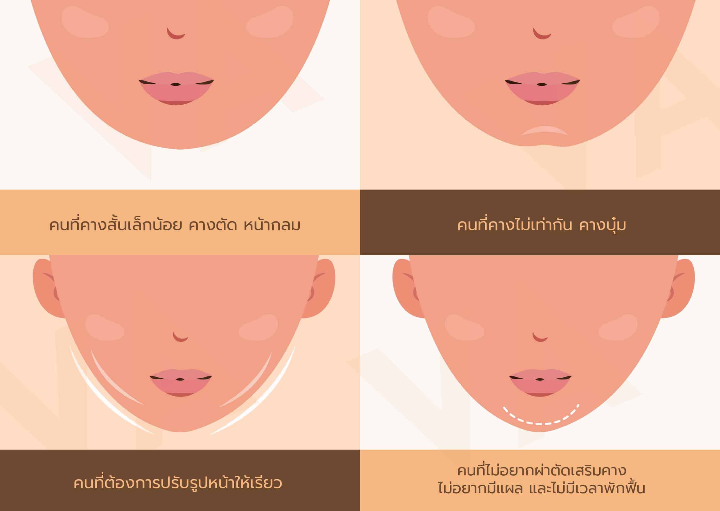 ฟิลเลอร์คาง ปรับรูปหน้า เติมเต็มคางให้สวยเป๊ะ