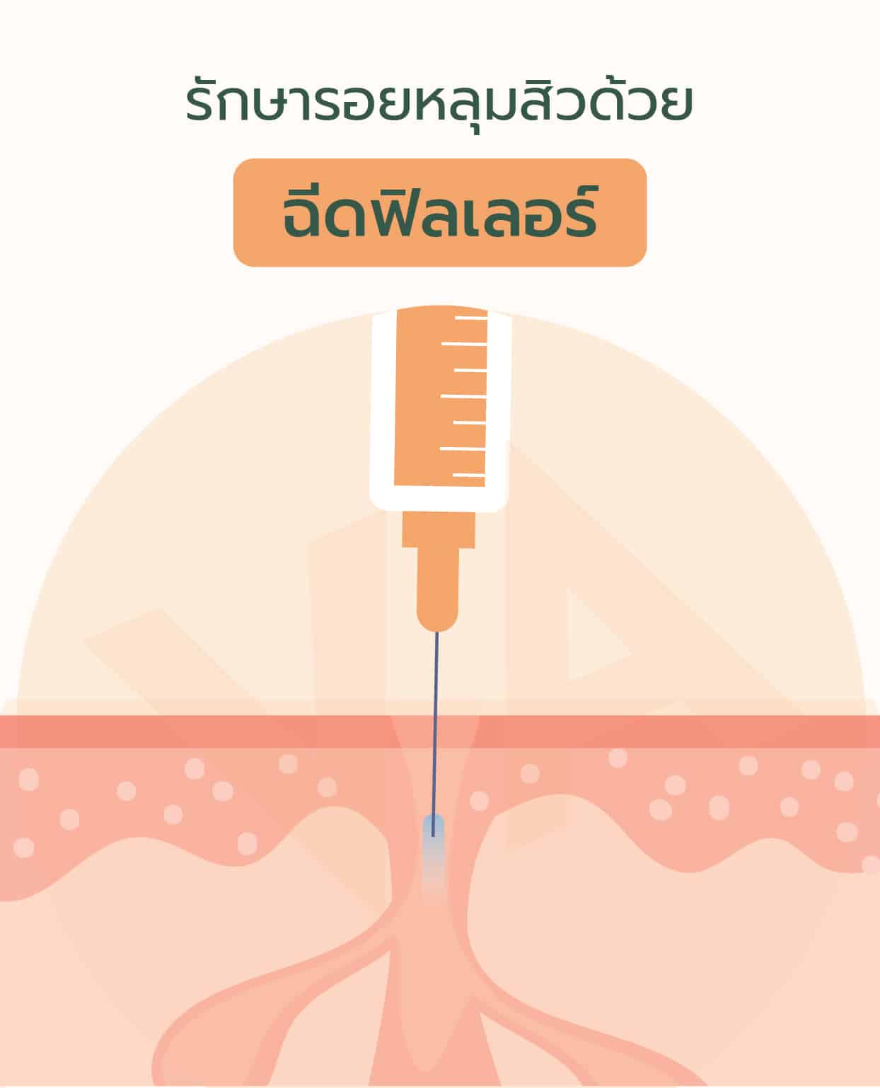 รักษารอยหลุมสิว เปลี่ยนผิวให้เรียบเนียนด้วย เครื่องเลเซอร์ Venus Viva MD