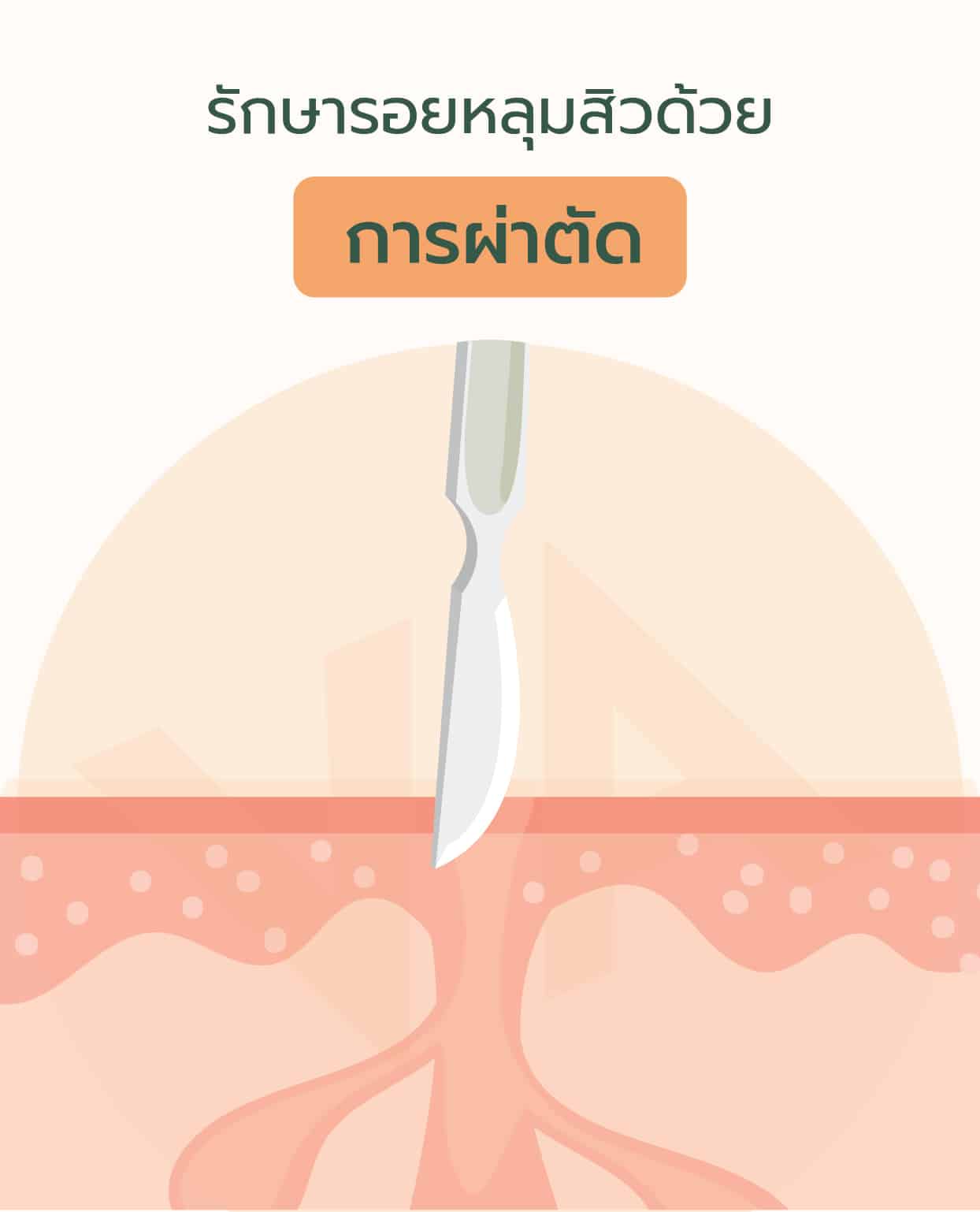 รักษารอยหลุมสิว เปลี่ยนผิวให้เรียบเนียนด้วย เครื่องเลเซอร์ Venus Viva MD